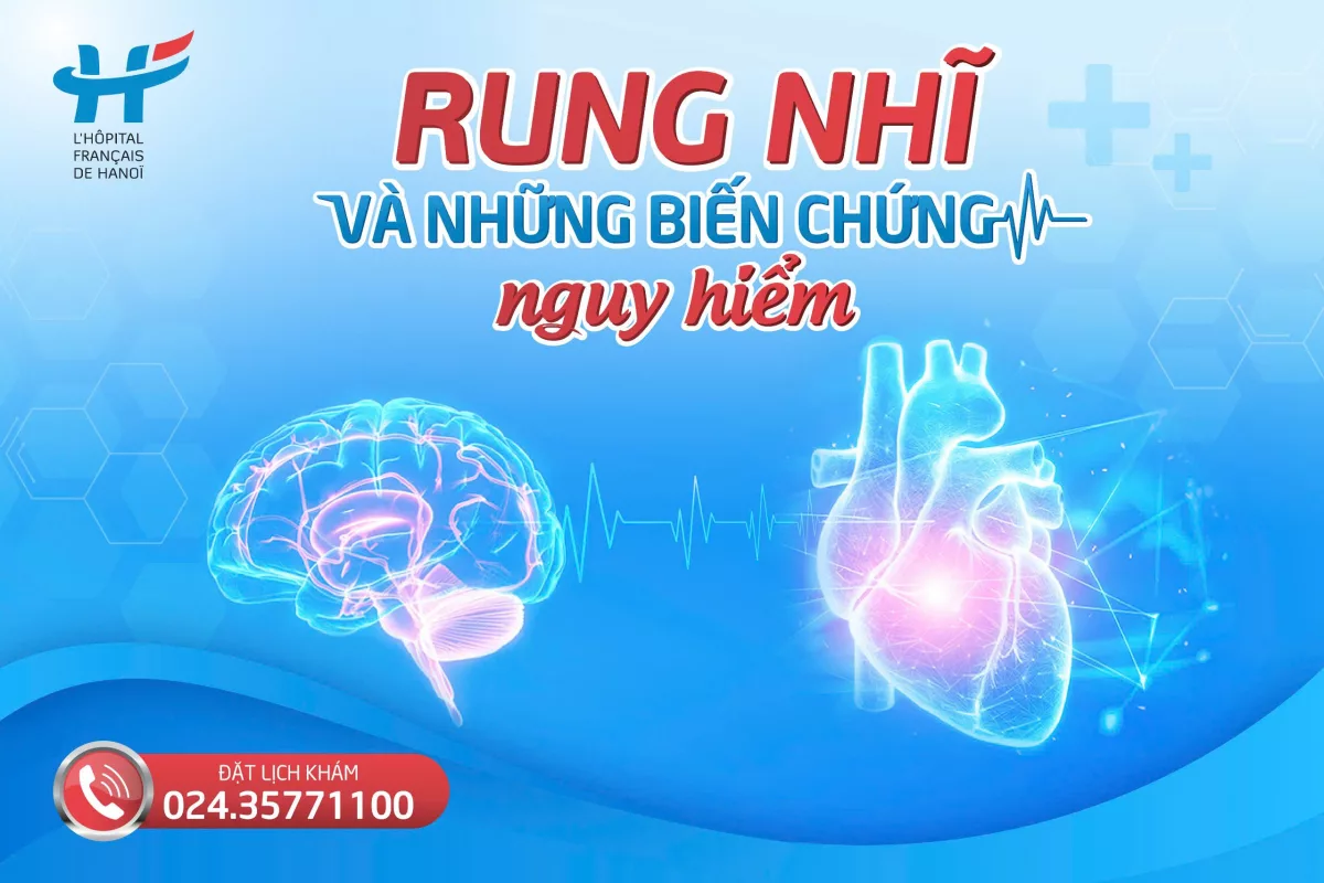 BỆNH RUNG NHĨ VÀ NHỮNG BIẾN CHỨNG NGUY HIỂM